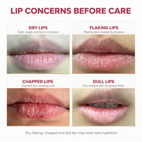 OEM Private Label Kerst Lipbalsem Set PDRN Hydraterende Lipmasker Fruitextract Hydraterende Droge Lipverzorging Cadeauset