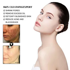 Blackhead Cleansing Mud Film To Lighten Acne Scars Tighten Pores Deeply Cleanse And Moisturize The Skin