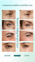 OTVENA Crème pour les yeux la plus vendue, hydratante, réparatrice, anti-poches, vente en gros OEM, 25 ml
