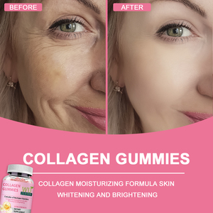 Suplemento dietético Multivitamínico Femenino Ayuda a mantener la energía Ayuda a proteger la piel Colágeno Gomitas - Product Image 2