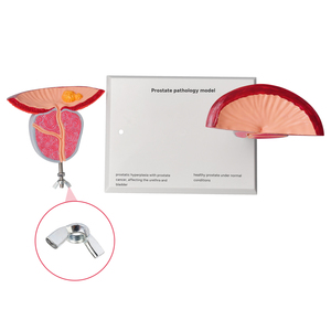 Modelo Anatómico Patológico de Próstata Humana para Enseñanza y Formación Médica, Material de PVC, Modelo Anatómico para Educación Científica - Product Image 3