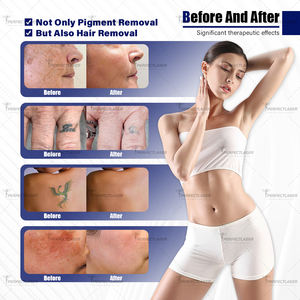 Dispositif professionnel de retrait de tatouage de picoseconde de <span class=keywords><strong>laser</strong></span> de <span class=keywords><strong>Nd</strong></span> <span class=keywords><strong>Yag</strong></span> commuté par <span class=keywords><strong>Q</strong></span> 532nm 755nm 1064nm 1320nm Machine <span class=keywords><strong>laser</strong></span> de Pico de mélanine de rupture - Product Image 5