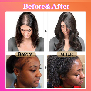 Toem Tự Nhiên Tinh Khiết Hữu Cơ Batana Điều Hòa Cho Tóc Xoăn Thúc Đẩy Tóc Mọc lại Với Số Lượng Lớn Nguyên Liệu Batana Dầu Cho Sự Tăng Trưởng Tóc - Product Image 3