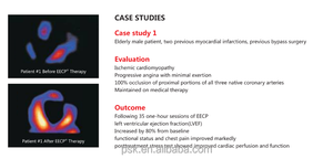 <span class=keywords><strong>EECP</strong></span>-apparaat externe contrapulsatie helpt de cardiovasculaire gezondheid, leef langer en gezonder - Product Image 6