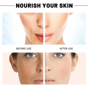 Vente en gros EELHOE Eau glycérine non grasse Acide de fruit ajouté hydratation toute la journée Sérum acide salicylique - Product Image 2