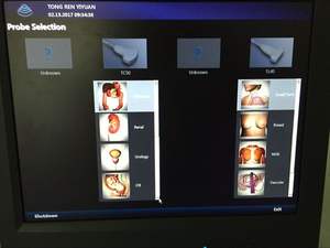 Zonecare <span class=keywords><strong>Ultrasound</strong></span> Perut Doppler Warna Lanjutan dengan Gambar Elastisitas - Product Image 4