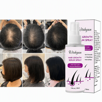 Sérum Capillaire Croissance Personnalisé OEM 100% Naturel et Biologique à l'Huile de Romarin, de Ricin et d'Amande en Spray pour Hommes et Femmes – Prévention de la Chute des Cheveux