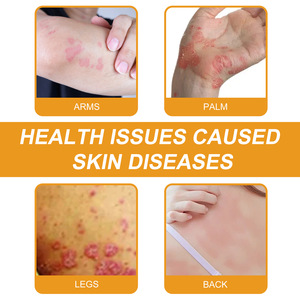 Offres Spéciales crème de soin au venin d'abeille Ximonth soulagement du psoriasis eczéma réparateur <span class=keywords><strong>Anti</strong></span> démangeaisons crème <span class=keywords><strong>anti</strong></span>-psoriasis nourrissante - Product Image 5