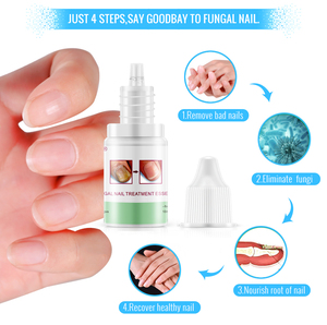 OMY LADY-Ensemble de <span class=keywords><strong>Traitement</strong></span> des Ongles pour Tuer les Champignons, Meilleure Réparation des Ongles, Arrêter la Croissance Fongique Efficace, Soins de Santé pour Ongles et Doigts - Product Image 3