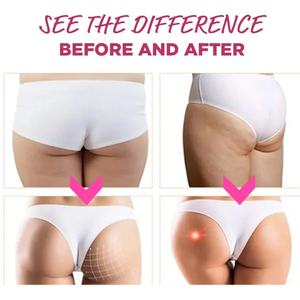 Chinaherb Wholesale Adult Vitamins and Buttocks Hips Gummies <b>Post</b>-Exercise Recovery Not for Newborns - Product Image 3