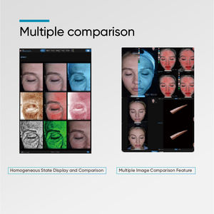 เครื่องวิเคราะห์ผิวหน้า 3 มิติ S7 ใช้พลังงาน AI วิเคราะห์ริ้วรอย จุดด่างดำ ความชุ่มชื้น พร้อมการทดสอบกว่า 15 รายการ บันทึกข้อมูลบนคลาวด์ เชื่อมต่อผ่านบลูทูธ/ไวไฟ รองรับปลั๊กไฟแบบญี่ปุ่น/อเมริกา - Product Image 3