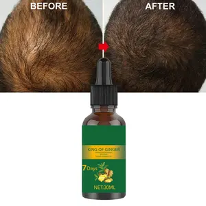 Natural Original Hair Growth Serum Kit Serum For China Luxury Black Hair Growth Oil Bottles