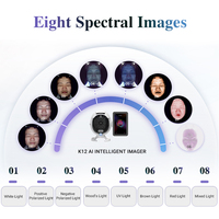Analyseur de beauté professionnel Winkonlaser à intelligence artificielle, système complet de détection de la santé de la peau, du cuir chevelu et des cheveux, en vente