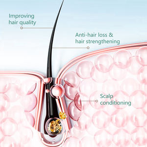 Champú de plantas naturales que contiene menta de romero, champú de <span class=keywords><strong>crecimiento</strong></span> rápido de pelo fuerte de hojas de ciprés, champú de control de Aceite hidratante - Product Image 3