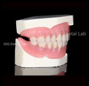 Prothèses complètes en acrylique personnalisées de haute qualité à bas <span class=keywords><strong>prix</strong></span>, pouvant être retirées pour être nettoyées, nettoyage plus pratique - Product Image 4