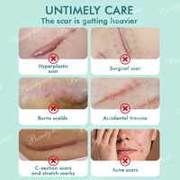Gel en silicone pour l'élimination des cicatrices Crème réparatrice efficace pour le traitement naturel des cicatrices du visage et du corps