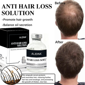 B เซรั่มดูแลผิวแบบเกาหลีสำหรับบำ<span class=keywords><strong>รุ</strong></span><span class=keywords><strong>ง</strong></span>ผิวที่เปล่<span class=keywords><strong>ง</strong></span>ปลั่<span class=keywords><strong>ง</strong></span>และให้<span class=keywords><strong>ผม</strong></span><span class=keywords><strong>ง</strong></span>อกใหม่สเต็มเซลล์ AC แบบพรีเมียมเปปไทด์โกลด์คอมเพล็กซ์ - Product Image 2