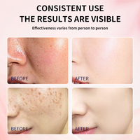 Crème éclaircissante anti-taches OEM à marque privée, Niacinamide Vitamine C, correcteur de taches brunes avancé, anti-âge