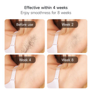 Voor Mlay T16 <span class=keywords><strong>Foto</strong></span>-<span class=keywords><strong>Epilator</strong></span> Gepulseerd Licht Laser Ipl Machine Voor Ontharingsgereedschap - Product Image 4