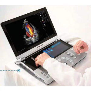 Vinno 6 <strong>Portable</strong> Color Doppler Ultrasound <strong>Scanner</strong> with Probes for Hospital &amp; Clinic Use - Product Image 3