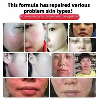 Sérum réparateur et régénérant pour la barrière cutanée Nano Skin, anti-rougeurs, crème réparatrice à la céramide pour le visage, soin post-intervention