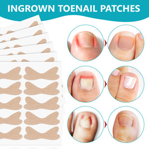 Parches para el Tratamiento de Uñas Encarnadas SEFUDUN al por Mayor, Kit de 120 Tiras Correctoras para Uñas Encarnadas con Lima y Levantador - Product Image 2