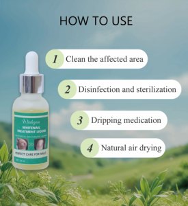 Líquido para <span class=keywords><strong>Eliminar</strong></span> Hongos en las Manos con Ingredientes Minerales, Exfoliante e Hidratante para Aclarar, Personalizable - Product Image 3