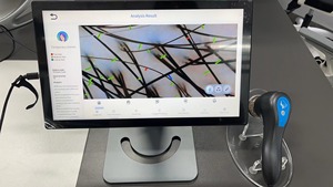 Microscope numérique portable pour cheveux, analyseur de cuir chevelu - Product Image 6