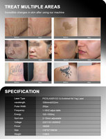 Appareil de suppression de tatouages au laser picoseconde Q-Switch à refroidissement semi-conducteur pour peeling au carbone et rajeunissement cutané, usage commercial