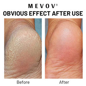 Crème pour les pieds à l'urée naturelle, hydratante pour les peaux sèches, <span class=keywords><strong>anti</strong></span>-fongique, éliminateur de <span class=keywords><strong>callosités</strong></span>, marque privée - Product Image 6