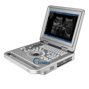 Mesin Doppler troli termurah, pemindai sonografi Laptop hitam & putih, dokter hewan BW70A - Product Image 1