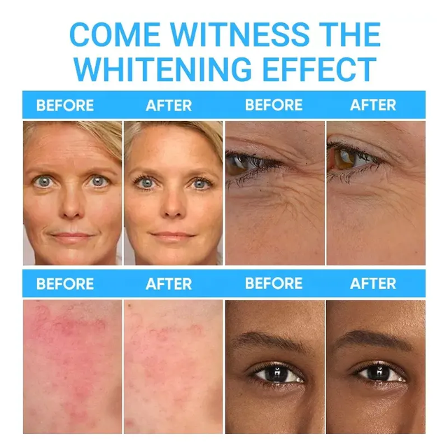 is glutathione cream effective Amazon.com: medicube AGE-R Glutathione Glow Capsule Facial Cream - Instant  Lifting Moisturizer - Collagen Peptide For Hydrating Glow - Improve  Blemishes, Uneven Skin Tone main image 0