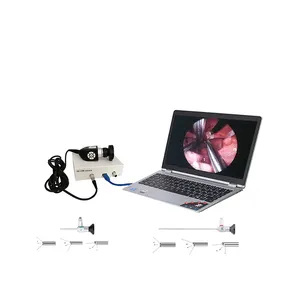 Endoscopio médico con usb, cámara de otoscopio de oreja HD ent