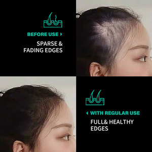 All'ingrosso olio biologico per la crescita dei capelli crema 100 per cento non raffinato puro nutriente Batana olio per la cura dei capelli - Product Image 3