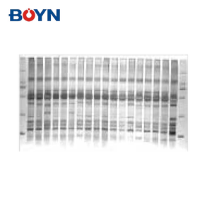 BNGDS-A210 BNGDS-A220自动凝胶成像分析系统PCR文档实验室凝胶文件成像系统 - Product Image 4