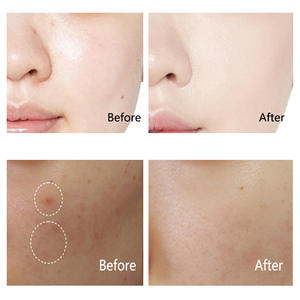 ครีมเรตินอลลดเลือนจุดด่างดำ วิตามินเอ บำรุงผิว คอลลาเจน กระชับผิว ลดริ้วรอย ขายส่ง ราคาพิเศษ - Product Image 5