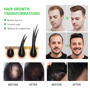 Sérum capillaire biologique nourrissant le cuir chevelu au GHK-Cu, réduit la chute des cheveux, poudre lyophilisée, biotine, collagène, peptide de cuivre, cosmétique - Product Image 5