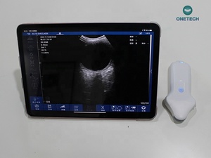 Sonda Doppler USB Wifi para Oftalmología, Recién Nacidos, Mascotas, Ultrasonido Ocular 8Mhz 11Mhz Microconvexo de Palma, Color, Reutilizable, CF PW PDI - Product Image 5