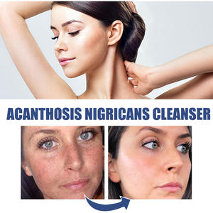 OEM Private Label Oil Free Facial Cleanser Anti Acne Organic Face Wash for All Skin - Product Image 5