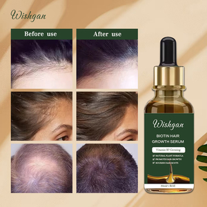 <span class=keywords><strong>Tratamiento</strong></span> de prevención de pérdida de aceite para el crecimiento del cabello tópico avanzado para hombres y mujeres promueve el suero de crecimiento del cabello de biotina saludable y fuerte - Product Image 3