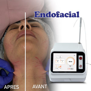 <span class=keywords><strong>Prix</strong></span> Usine Endopulse 635nm 980nm 1470nm Endo Fiber Liposuction 980 Y 1470 Haute Gamme - Product Image 6