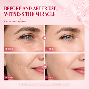 Sérum Visage Anti-Âge Coréen Personnalisé OEM, Soin de la Peau au PDRN de Saumon, Vitamine C et <span class=keywords><strong>E</strong></span>, Sérum Éclaircissant 4-en-1 - Product Image 4