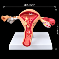 Modèle d'ovaire, modèle anatomique de l'organes reproducteurs féminins, outil éducatif médical