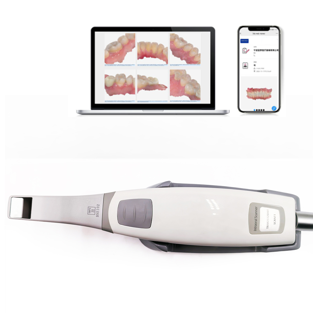 Dental 3d Intraoral Scanner 3.0 Pro with Free Software Digital CAD CMD Real Color Scanner 3d Dental Therapy Equipment