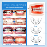 Dropshipping Shopify Aligneurs orthodontiques Correcteurs de dents invisibles transparents Stage One Two Three Dental Aligners