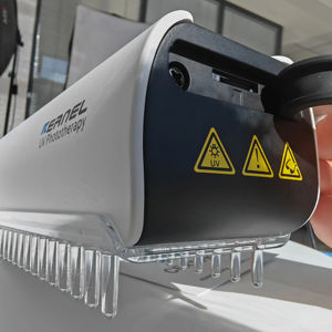 Produk peringkat teratas 2024 tren baru UVB genggam 311nm lampu pengobatan vitiligo pita sempit untuk penggunaan rumahan KN-4003BL2D - Product Image 1