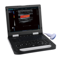 Escáner de Ultrasonido para Diagnóstico de Gestación Animal, Máquina de Ultrasonido Veterinaria Portátil con Doppler a Color
