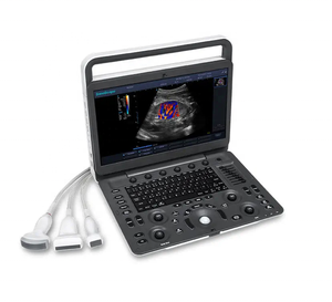 Sonoscape E1 Exp Échographe Doppler Couleur Sonoscape B/N – Prix de l'Échographe USG - Product Image 1