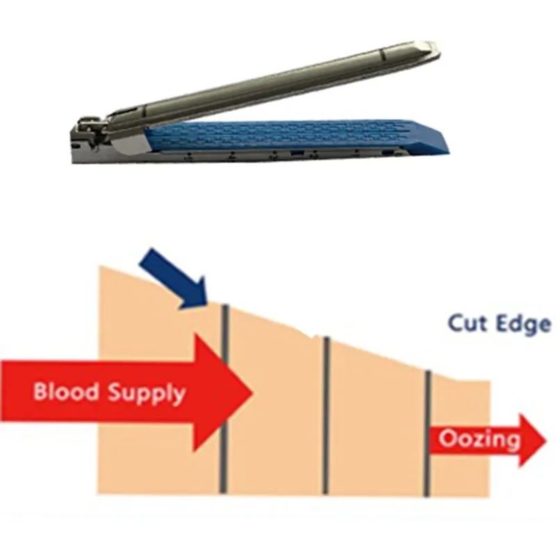 Zhimedical tıbbi tek kullanımlık endoskopik lineer kesme zımba