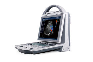 Escáner de Ultrasonido <span class=keywords><strong>Doppler</strong></span> Color para Diagnóstico Veterinario, con Monitor LCD de 10.4 Pulgadas sin Necesidad de Lavado, Certificado ISO - Product Image 5